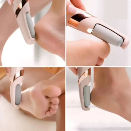 Rechargeable Callus Remover