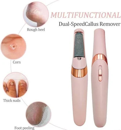 Rechargeable Callus Remover
