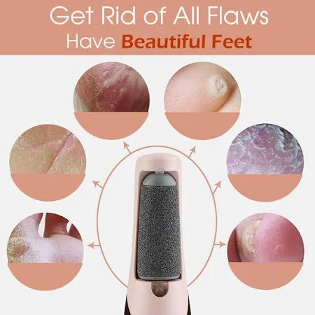 Rechargeable Callus Remover